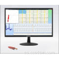 Holter Ecg 24 Horas